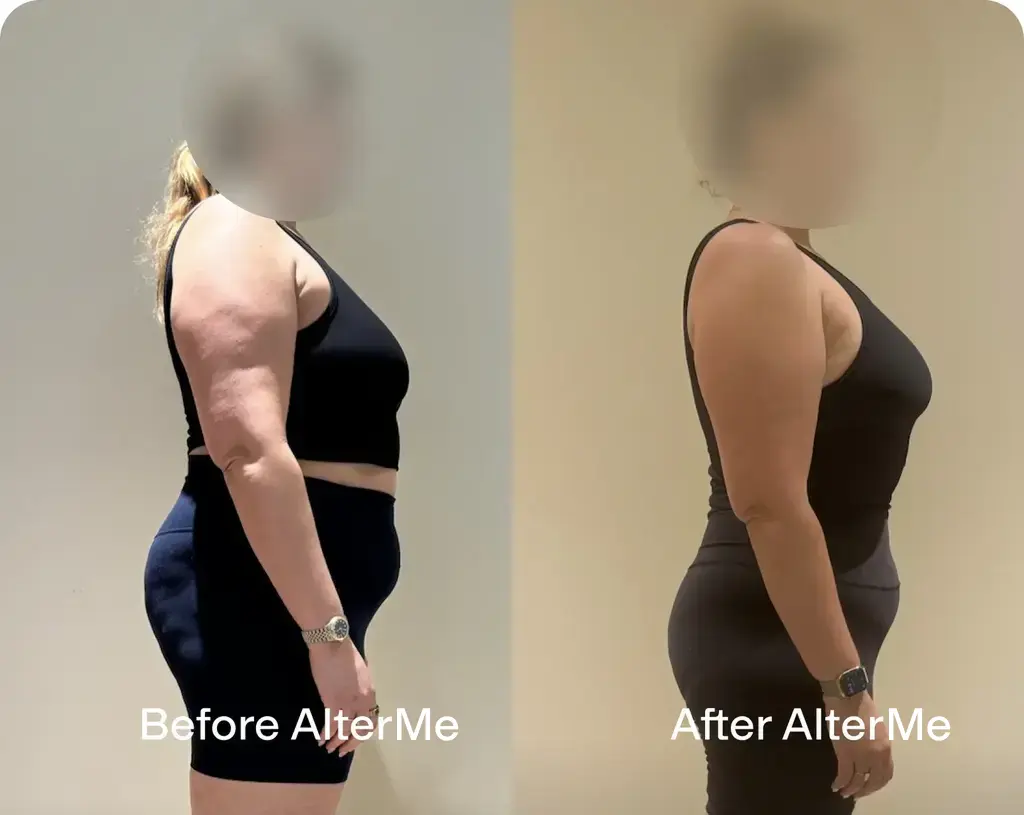Before and After